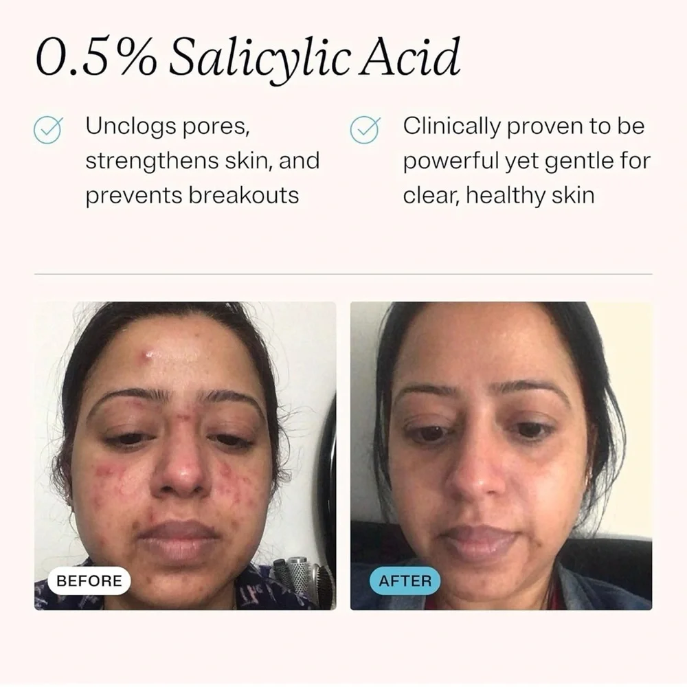 3/$12 MDacne Hydrating Customized Cleanser 2oz